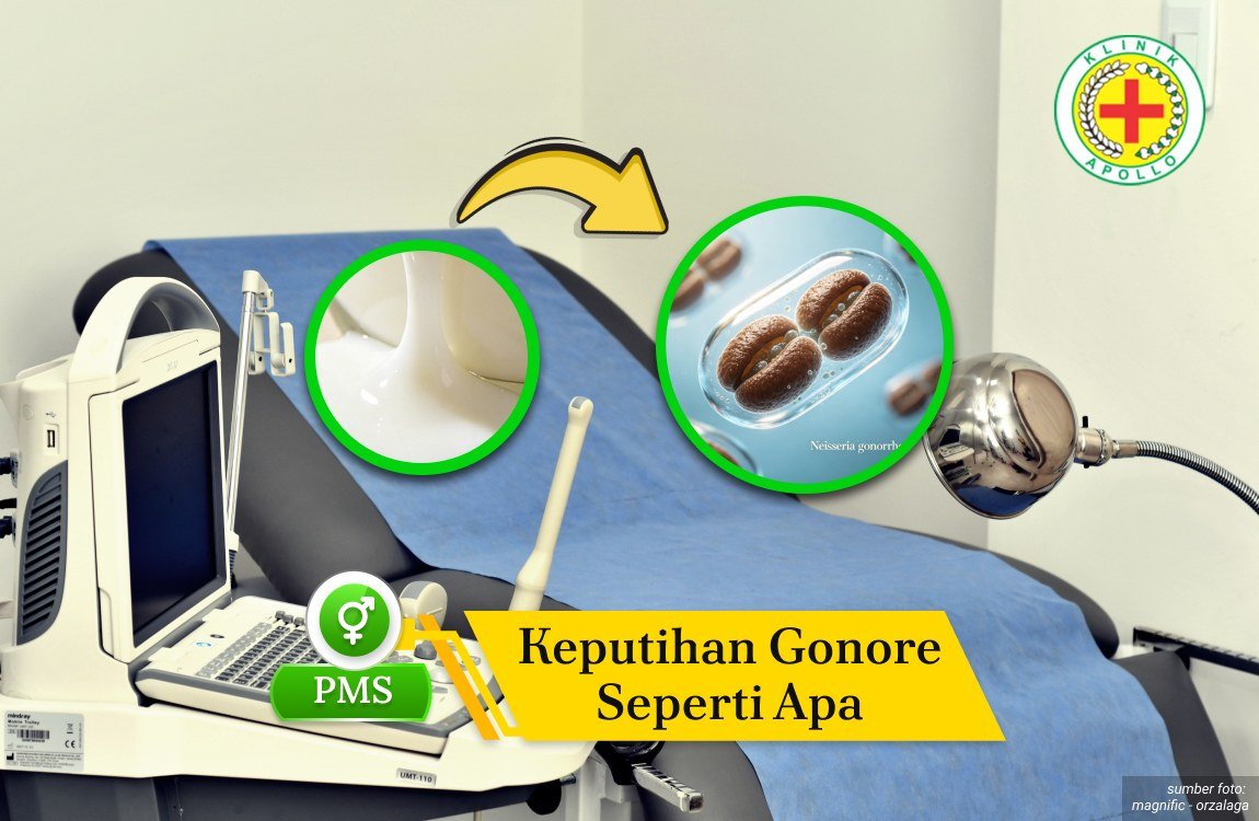 Ilustrasi Keputihan Gonore Seperti Apa.