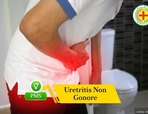 Uretritis Non Gonore: Gejala, Penyebab, Pengobatan