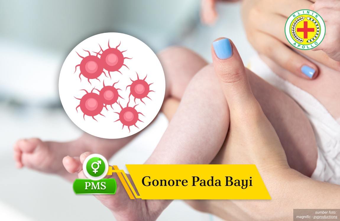 Ilustrasi Gonore pada Bayi.