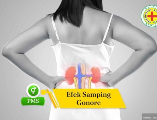 Efek Samping Gonore pada Pria dan Wanita Serta Risikonya