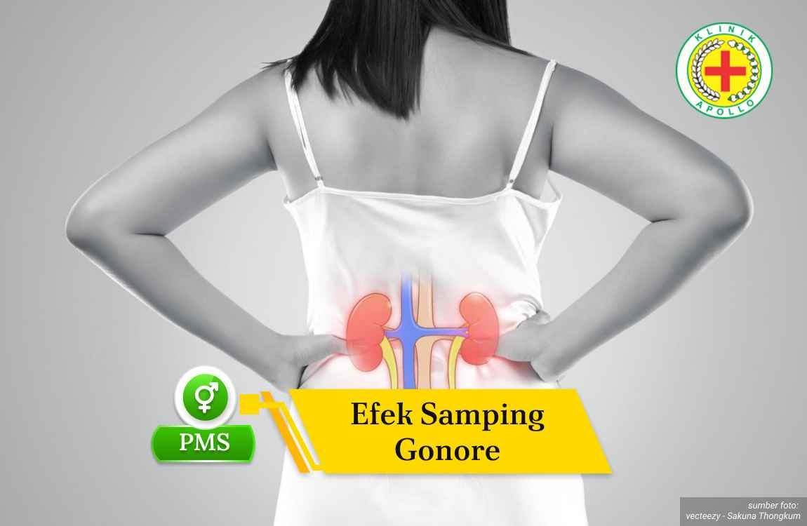 Ilustrasi Efek Samping Gonore.