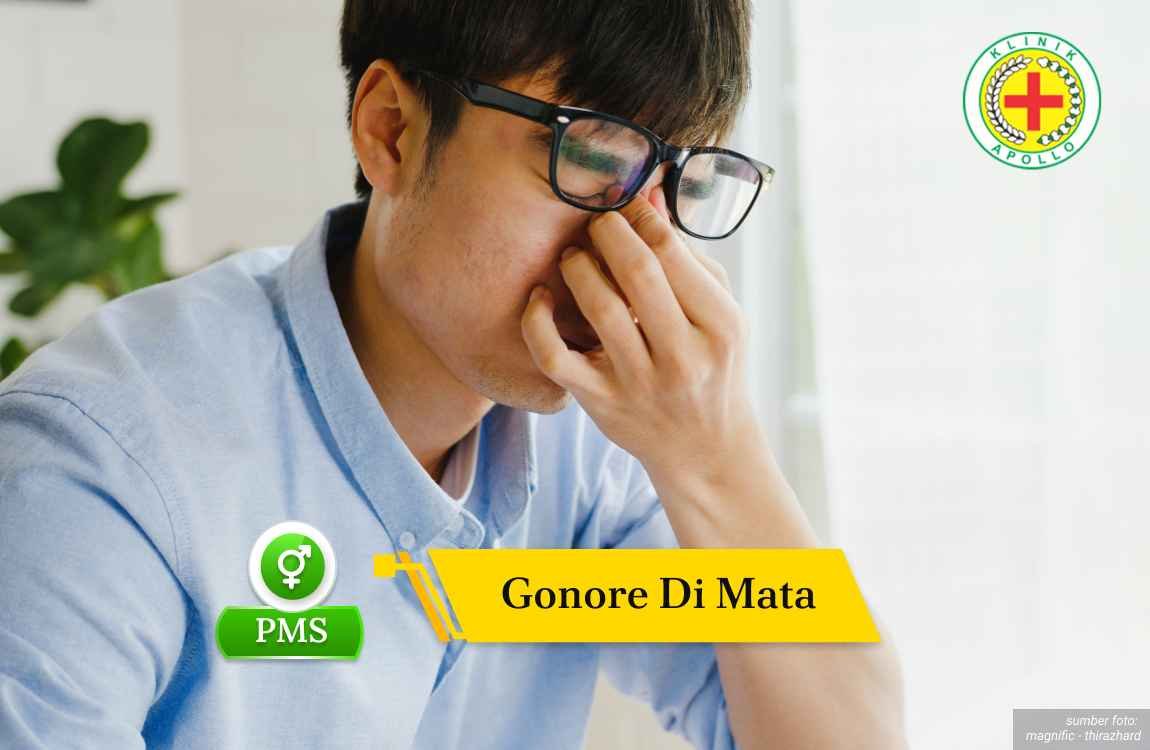 Ilustrasi Gonore di Mata.