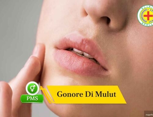 Gonore di Mulut: Kenali Gejala dan Cara Memastikannya