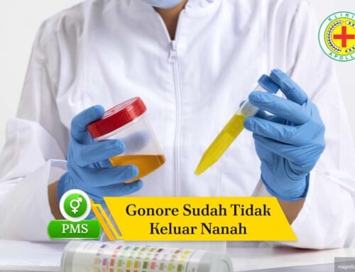 Gonore Sudah Tidak Keluar Nanah, Apakah Artinya Sembuh?