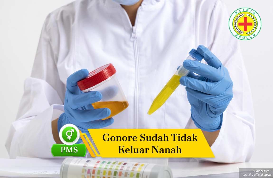 Ilustrasi Gonore Sudah Tidak Keluar Nanah.