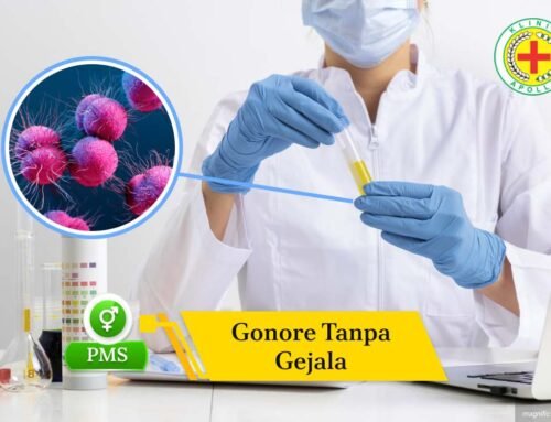 Waspada Gonore Tanpa Gejala, Kenali Bahaya & Risikonya