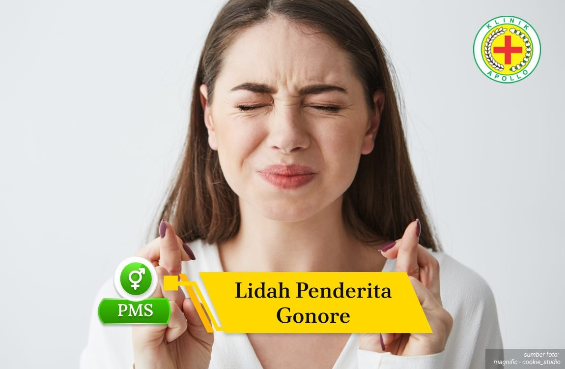 Ilustrasi Lidah Penderita Gonore.