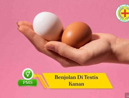 Benjolan di Testis Kanan: Penyebab dan Cara Mengatasinya