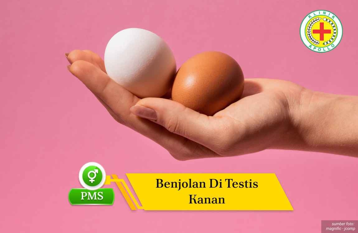 Kenali Penyebab Benjolan di Testis Kanan