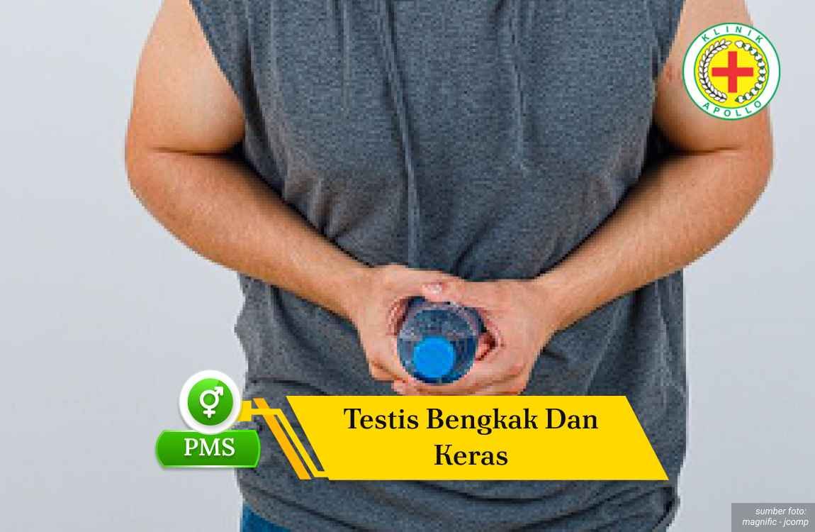 Ilustrasi Testis Bengkak dan Keras.
