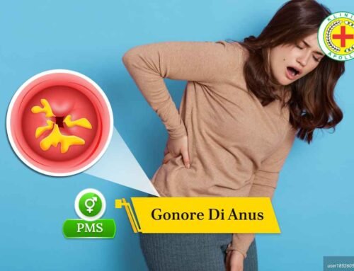 Kenali Gejala Gonore di Anus dan Cara Penanganannya