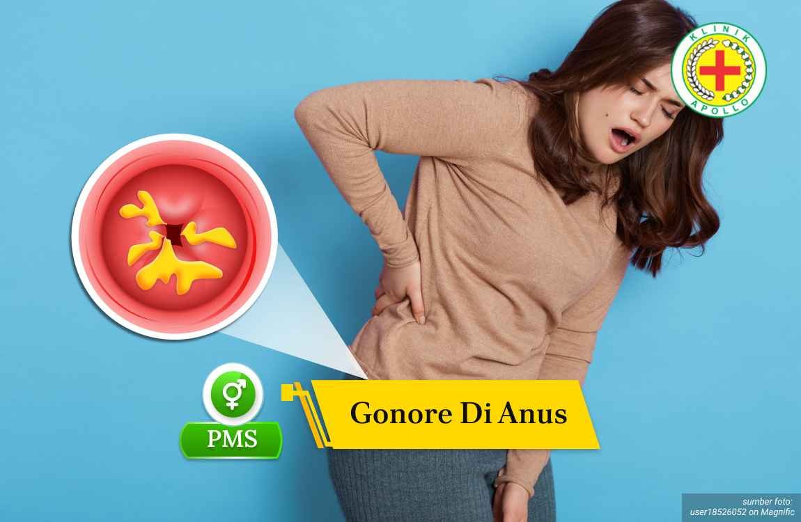 gonore di anus Ilustrasi Gonore di Anus.