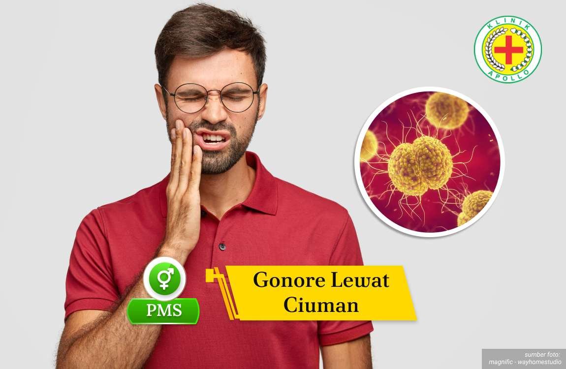 Ilustrasi Gonore Lewat Ciuman.