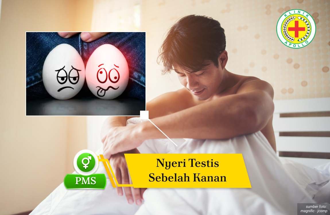 nyeri testis sebelah kanan Ilustrasi Nyeri Testis Sebelah Kanan.