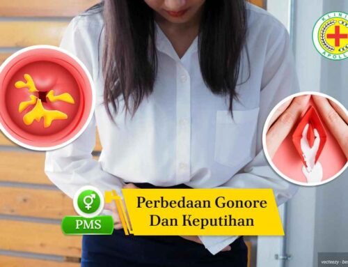 Perbedaan Gonore dan Keputihan yang Wajib Anda Ketahui