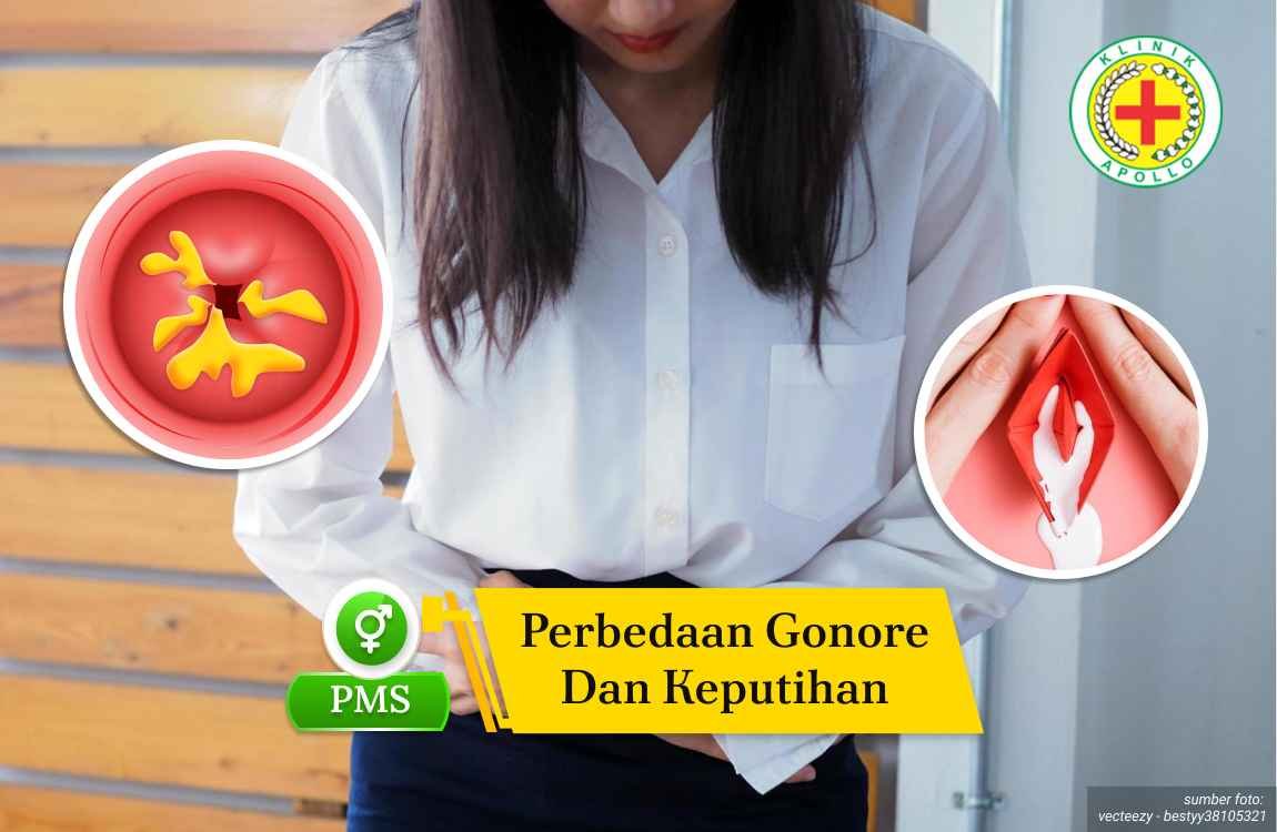 Ilustrasi Perbedaan Gonore dan Keputihan.