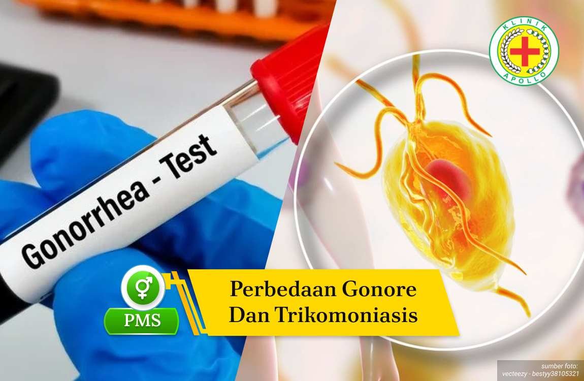 Ilustrasi Perbedaan Gonore dan Trikomoniasis.