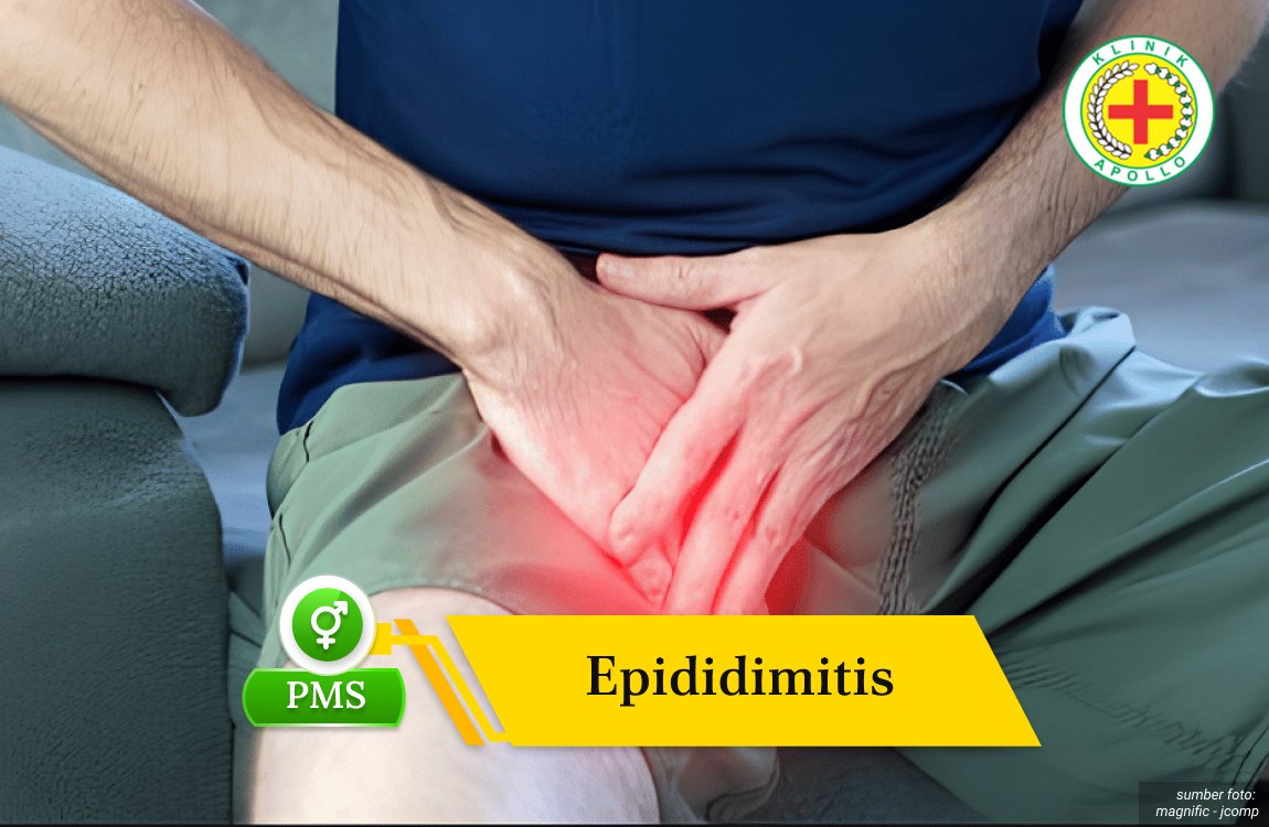 epididimitis Ilustrasi Epididimitis.