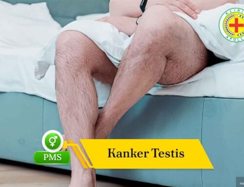 Kanker Testis: Gejala, Penyebab, dan Pemeriksaan