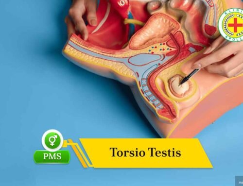 Torsio Testis: Gejala, Penyebab, dan Penanganan