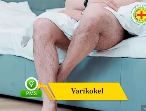 Apa itu Varikokel? Kenali Gejala, Bahaya, dan Pengobatannya