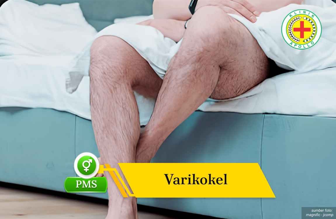 Ilustrasi Varikokel.